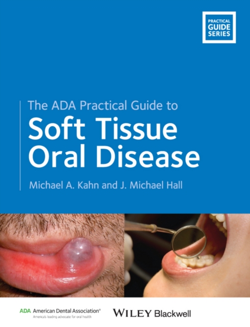 ADA Practical Guide to Soft Tissue Oral Disease