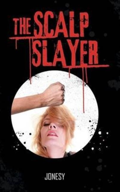 Scalp Slayer