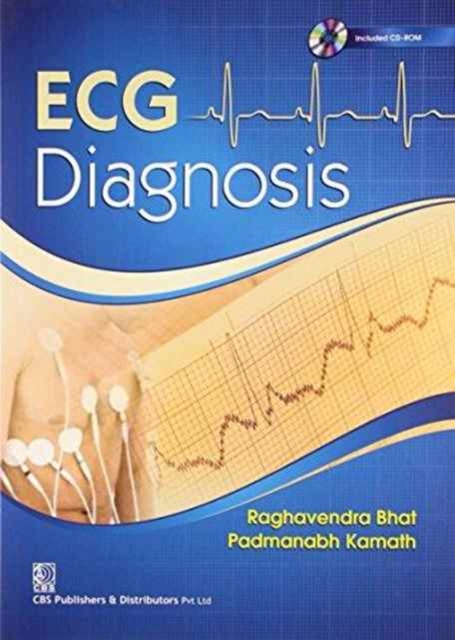 ECG Dianosis