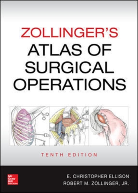 Zollinger's Atlas of Surgical Operations, Tenth Edition