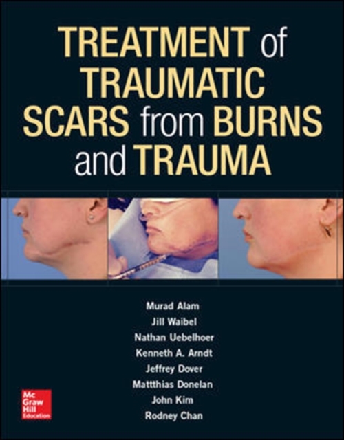 Treatment of Scars from Burns and Trauma