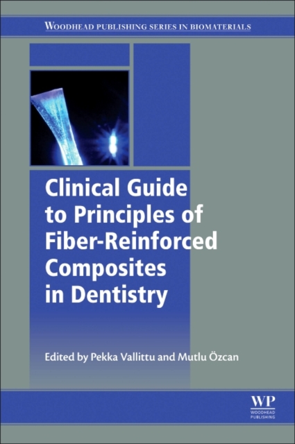 Clinical Guide to Principles of Fiber-Reinforced Composites in Dentistry