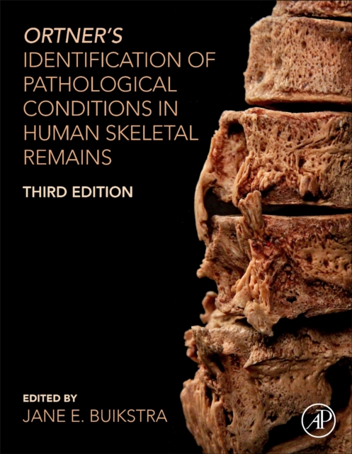 Ortner's Identification of Pathological Conditions in Human Skeletal Remains