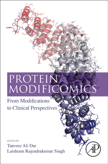 Protein Modificomics