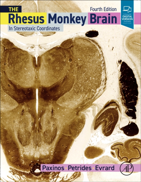 Rhesus Monkey Brain in Stereotaxic Coordinates