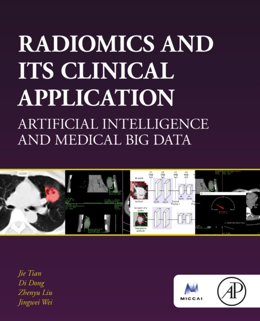 Radiomics and Its Clinical Application