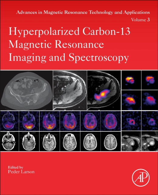 Hyperpolarized Carbon-13 Magnetic Resonance Imaging and Spectroscopy