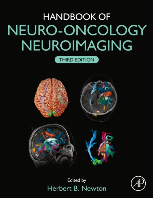 Handbook of Neuro-Oncology Neuroimaging