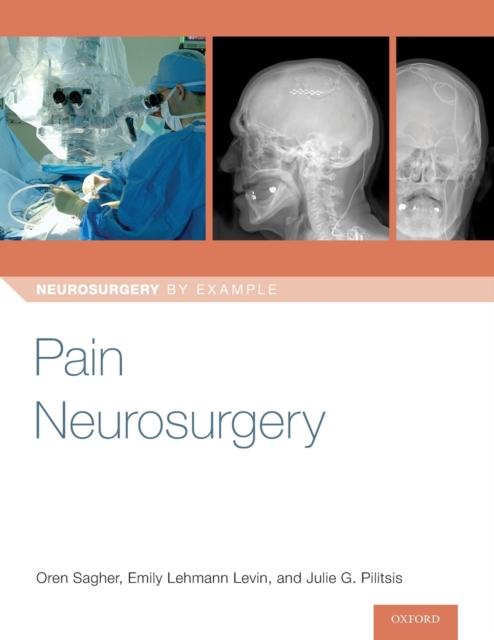 Pain Neurosurgery