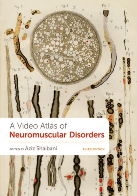 Video Atlas of Neuromuscular Disorders