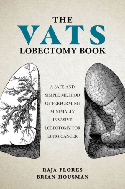 VATS Lobectomy Book