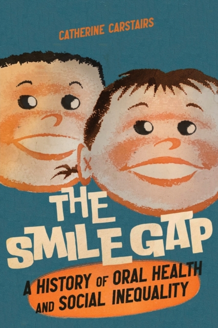 Smile Gap