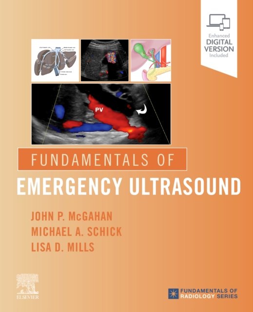 FUNDAMENTALS OF EMERGENCY ULTRASOUND