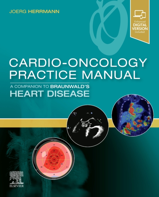 Cardio-Oncology Practice Manual: A Companion to Braunwald's Heart Disease