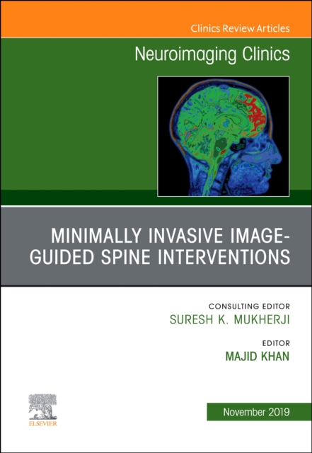 Spine Intervention, An Issue of Neuroimaging Clinics of North America