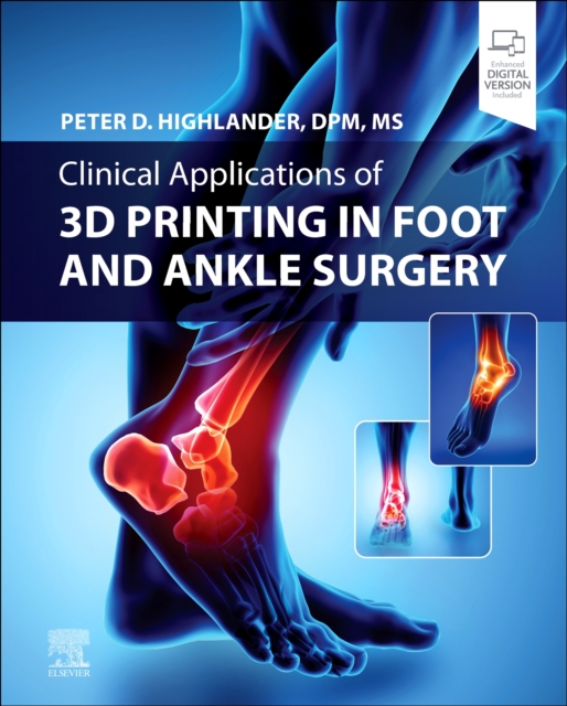 Clinical Applications of 3D Printing in Foot and Ankle Surgery