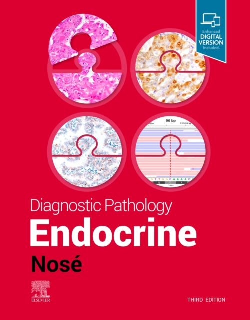 Diagnostic Pathology: Endocrine