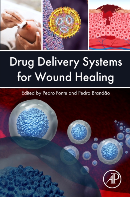 Drug Delivery Systems for Wound Healing