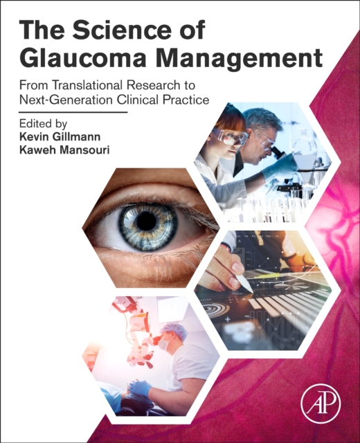 Science of Glaucoma Management