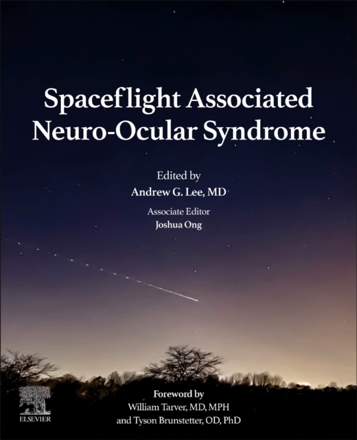 Spaceflight Associated Neuro-Ocular Syndrome