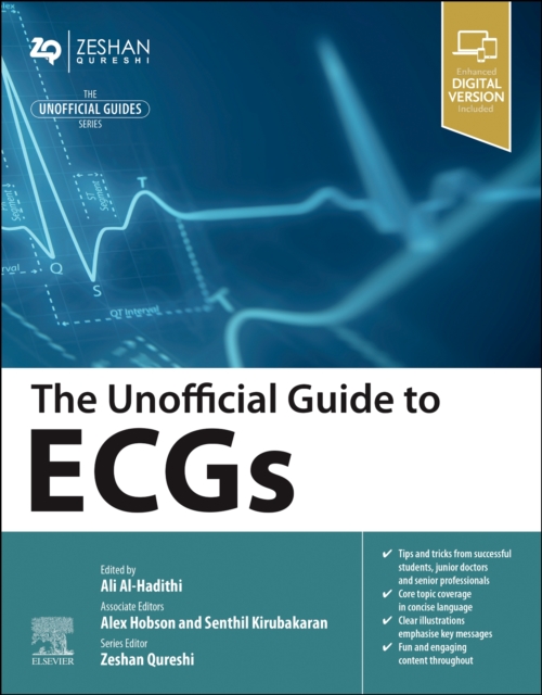 Unofficial Guide to ECGs