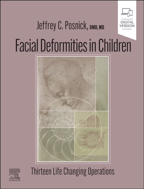 Facial Deformities in Children