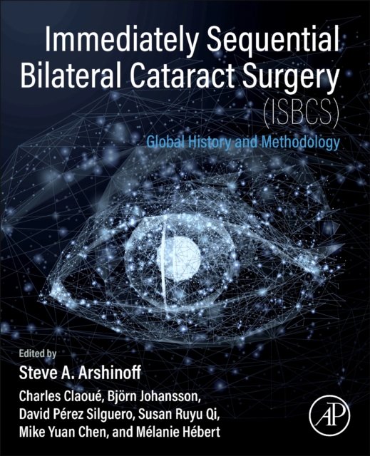 Immediately Sequential Bilateral Cataract Surgery (ISBCS)