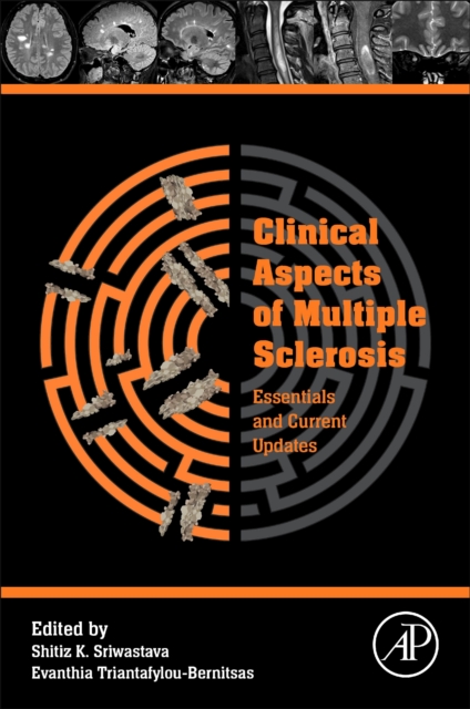 Clinical Aspects of Multiple Sclerosis Essentials and Current Updates