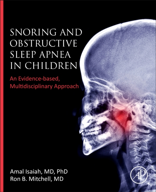 Snoring and Obstructive Sleep Apnea in Children