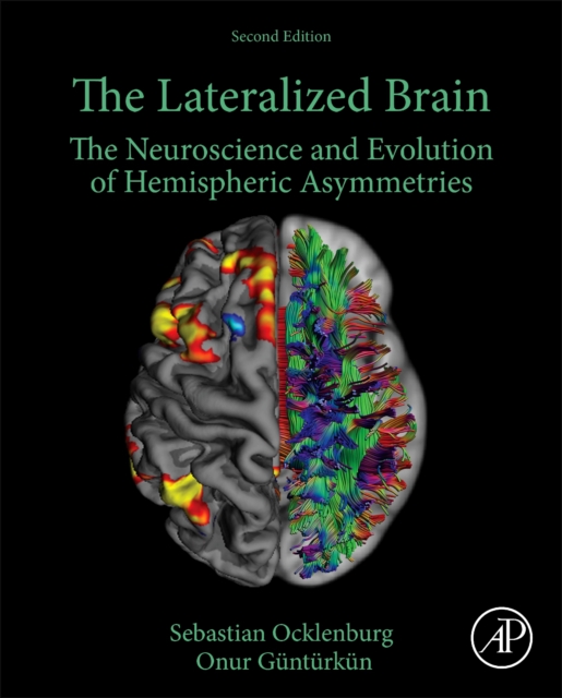 Lateralized Brain