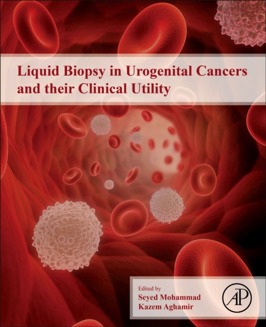Liquid Biopsy in Urogenital Cancers and their Clinical Utility