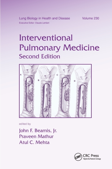 Interventional Pulmonary Medicine