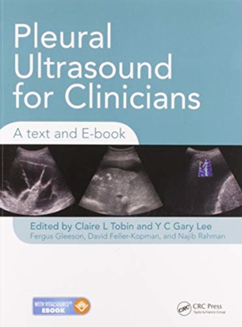 Pleural Ultrasound for Clinicians