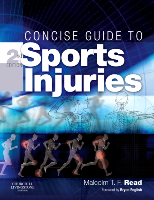 Concise Guide to Sports Injuries