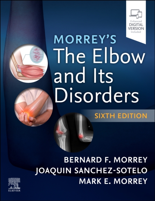 Morrey's The Elbow and Its Disorders