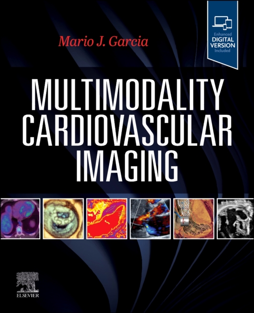 Multimodality Cardiovascular Imaging