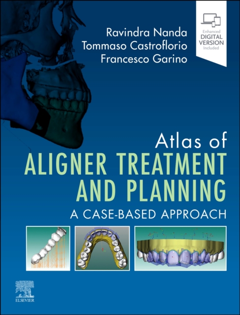 Atlas of Aligner Treatment and Planning