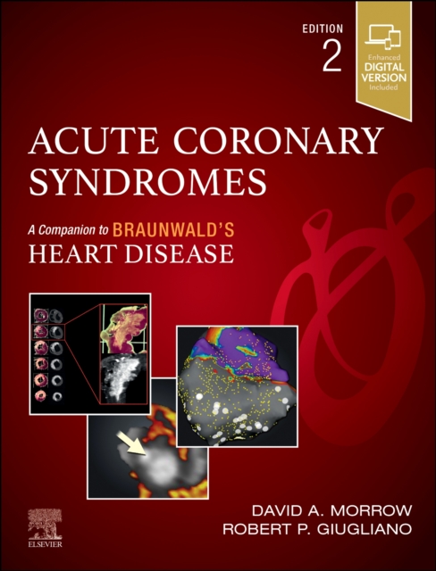 Acute Coronary Syndromes