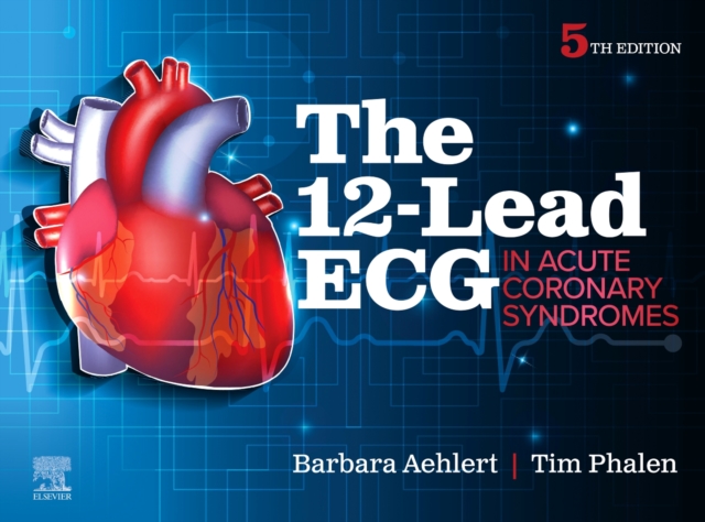 12-Lead ECG in Acute Coronary Syndromes