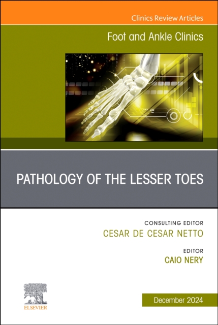 Pathology of the Lesser Toes, An issue of Foot and Ankle Clinics of North America