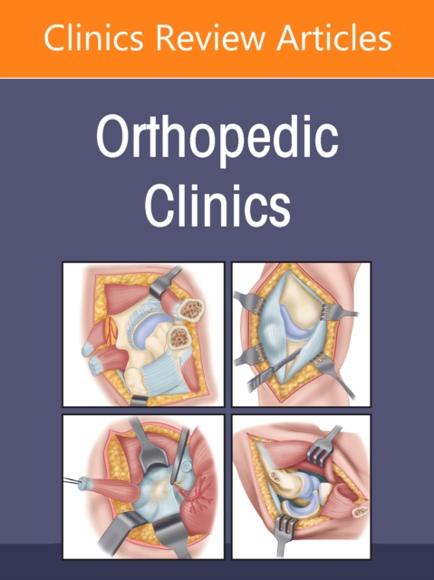 Quality, Value, and Patient Safety in Orthopedic Surgery, An Issue of Orthopedic Clinics