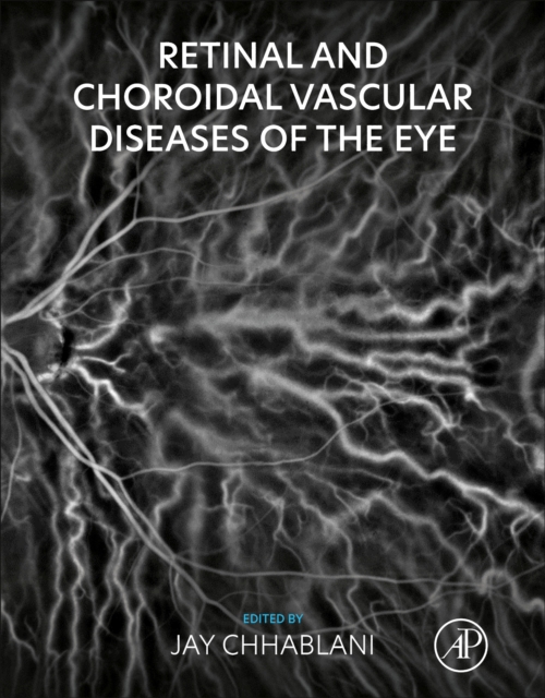 Retinal and Choroidal Vascular Diseases of the Eye