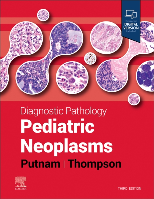 Diagnostic Pathology: Pediatric Neoplasms