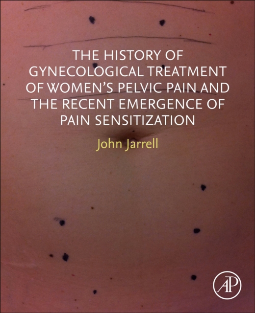 History of Gynecological Treatment of Women’s Pelvic Pain and the Recent Emergence of Pain Sensitization