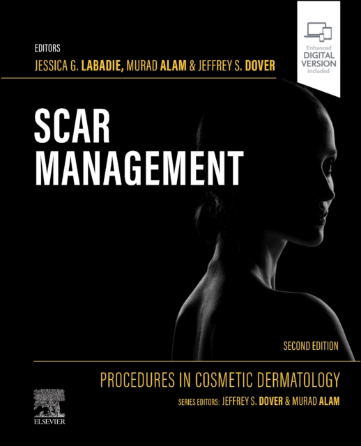 Procedures in Cosmetic Dermatology: Scar Management