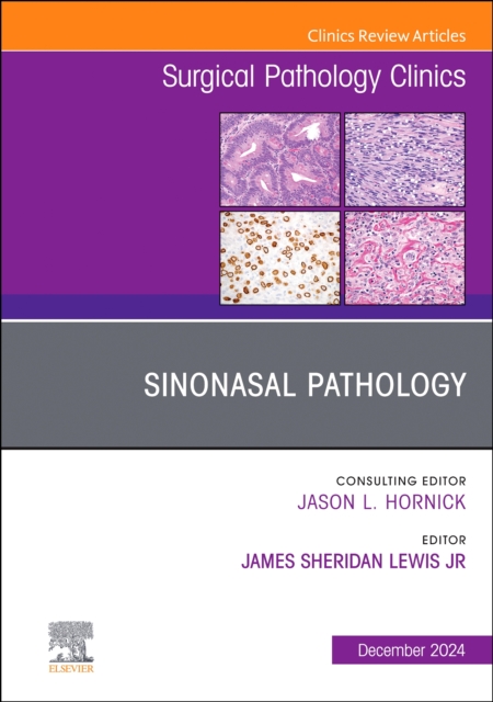 Sinonasal Pathology, An Issue of Surgical Pathology Clinics