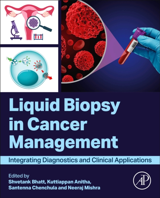 Liquid biopsy in Cancer Management