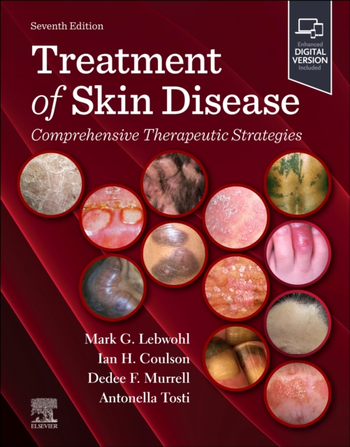 Treatment of Skin Disease: Comprehensive Therapeutic Strategies