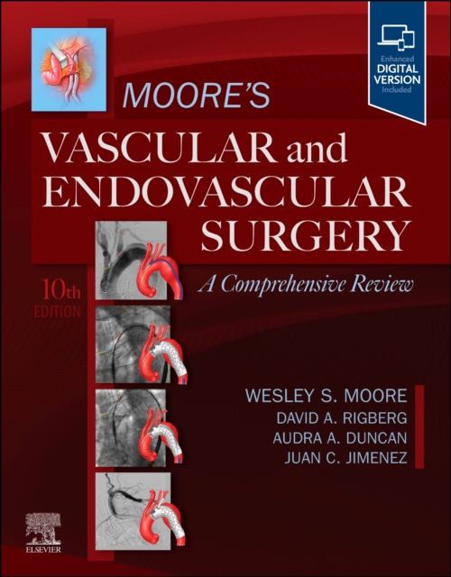 Moore's Vascular and Endovascular Surgery: A Comprehensive Review