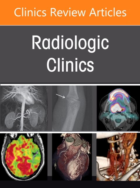 Pearls and Pitfalls in Thoracic Disease Imaging, An Issue of Radiologic Clinics of North America
